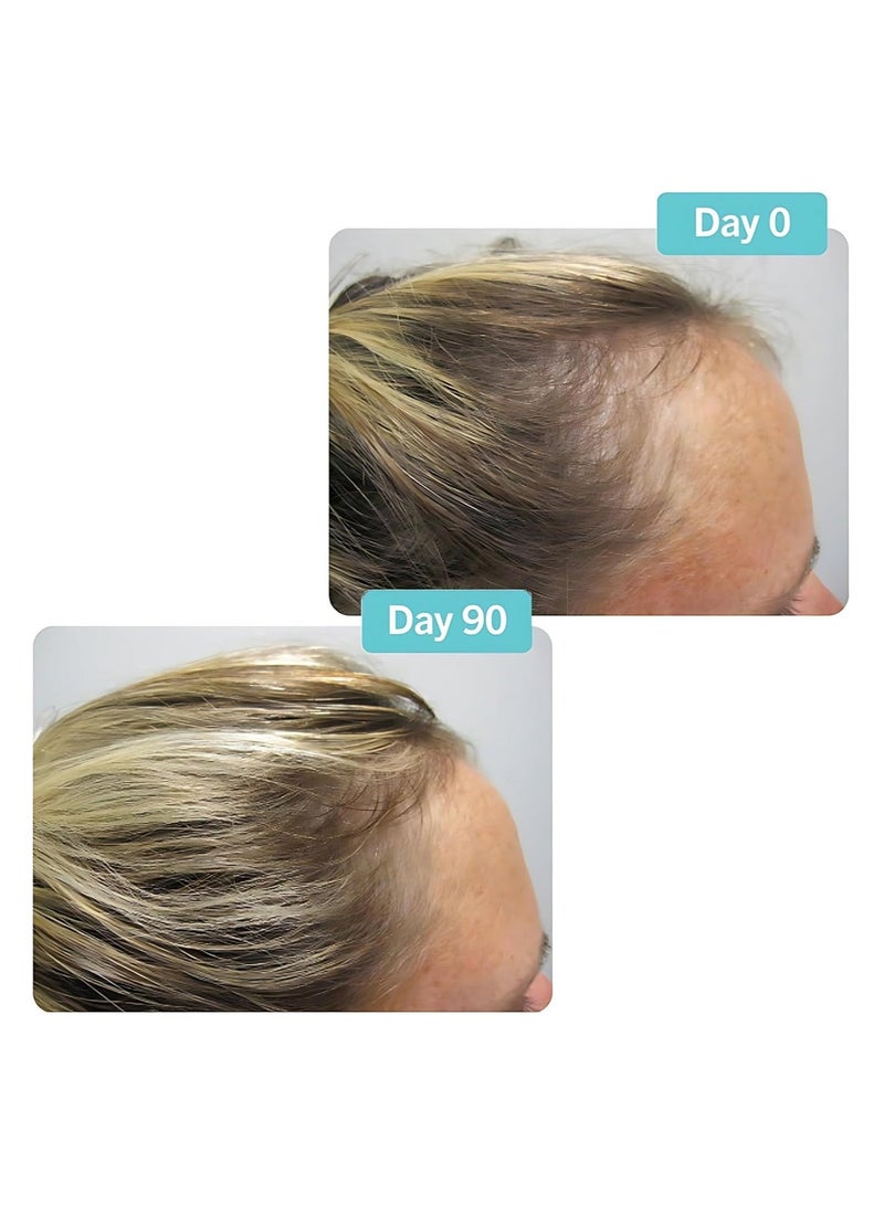 Viviscal Professional Hair Growth Supplement for Men and Women with Iron, Biotin, Zinc, Vitamin C, Nourish Thinning Hair and Increase Hair Thickness, Hair Multivitamins for Men and Women - 60 Tablets - Image 3